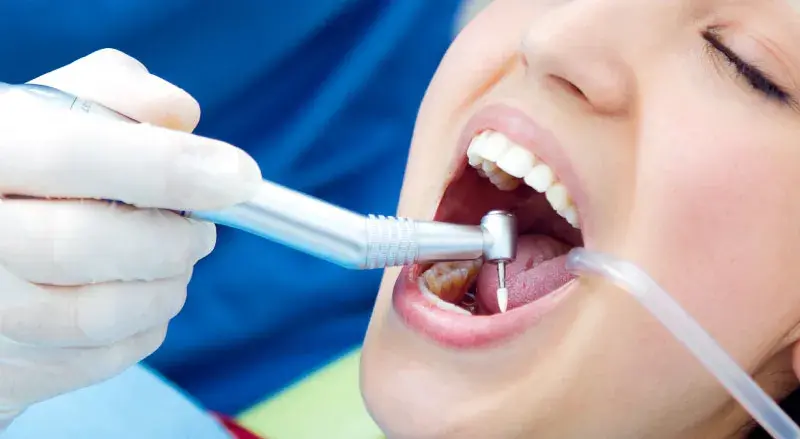 limpieza dental