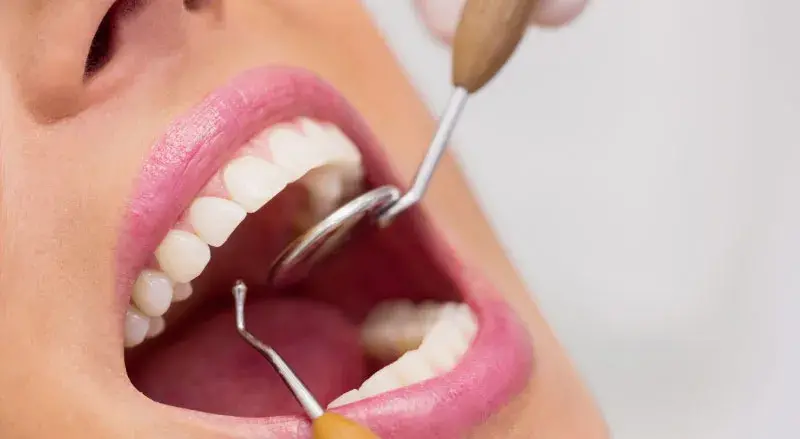 periodoncia odontología general y odontopediatría en maracena