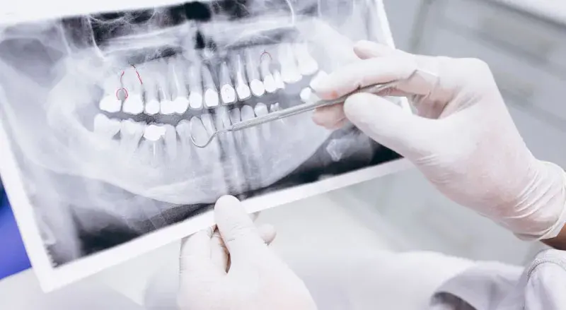 pruebas diagnósticas odontología general y odontopediatría en maracena