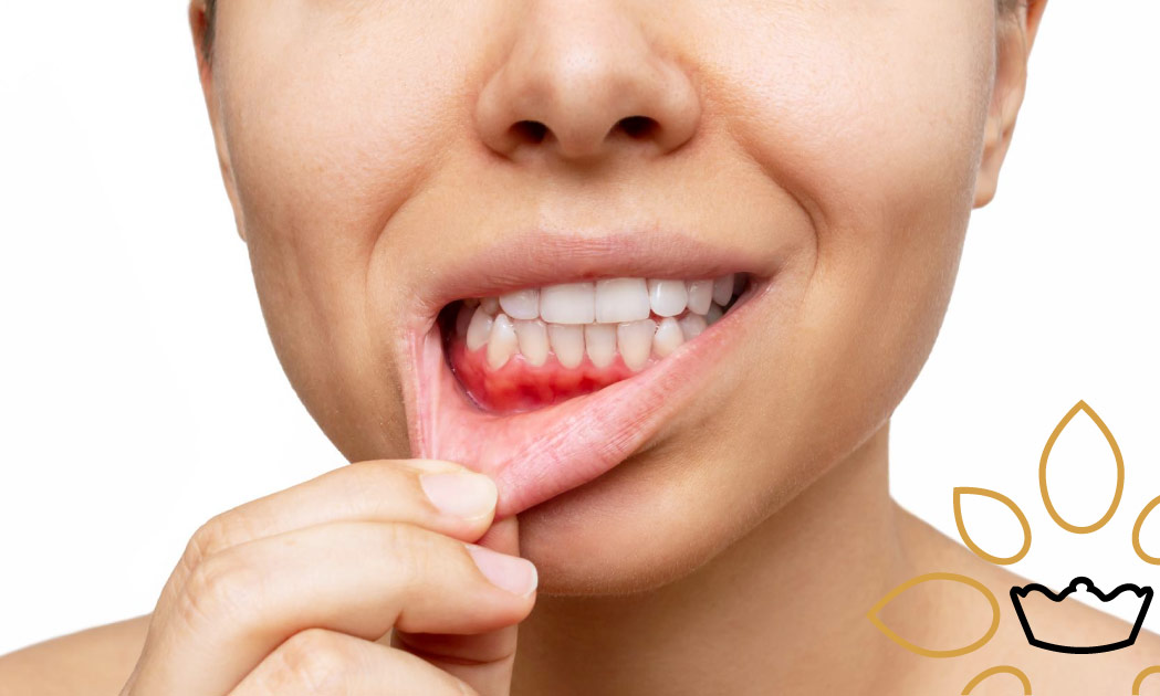 Blog: Riesgos a medio y largo plazo de la enfermedad periodontal. Dentista en Maracena