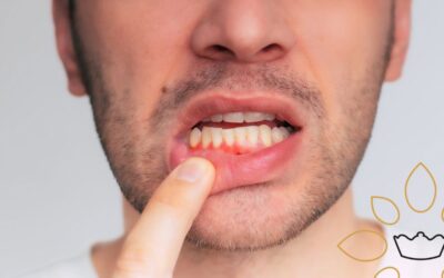 ¿Qué es la periodontitis y cómo se trata? Síntomas, fases y cuándo acudir al dentista